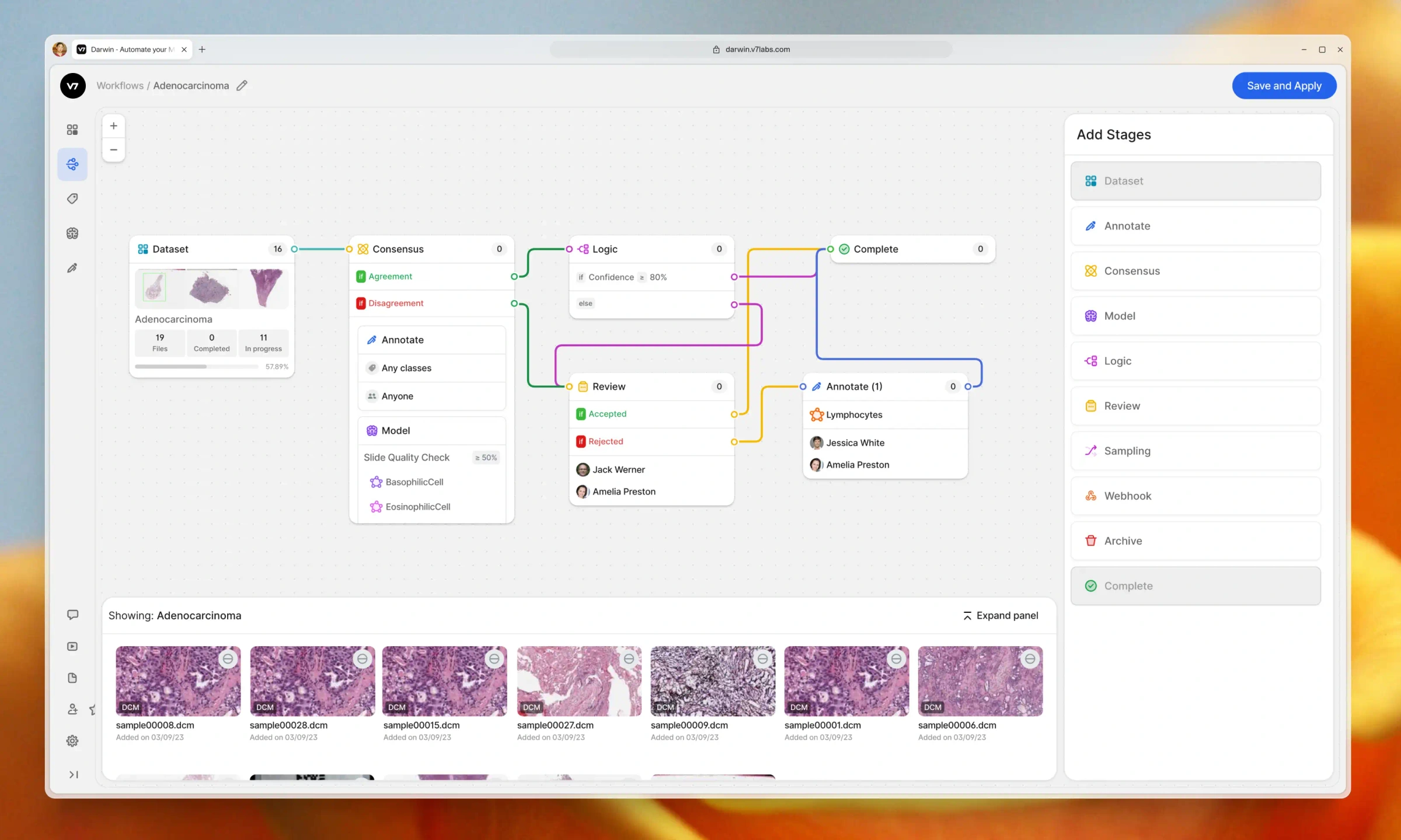 V7 Darwin | AI Data Labeling & ML Training Data Platform